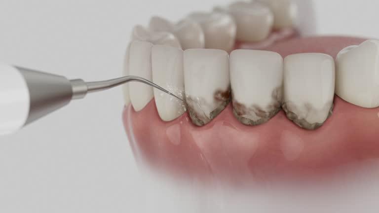 Reliable Dental contractor in Franklin Center, NJ by Dentist Open Now